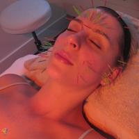 Australian Acupuncture Clinics image 1